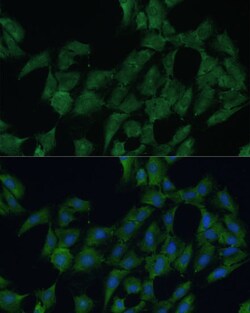 Invitrogen DDX3Y Polyclonal Antibody 100 &mu;L; Unconjugated:Antibodies,