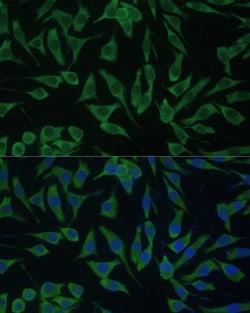 Invitrogen DDX3Y Polyclonal Antibody 100 &mu;L; Unconjugated:Antibodies,