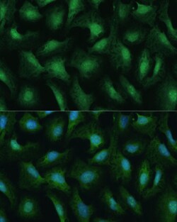 Invitrogen DDX3Y Polyclonal Antibody 100 &mu;L; Unconjugated:Antibodies,