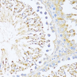 Invitrogen DDX3Y Polyclonal Antibody 100 &mu;L; Unconjugated:Antibodies,