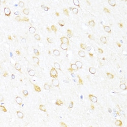 Invitrogen DDX3Y Polyclonal Antibody 100 &mu;L; Unconjugated:Antibodies,