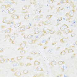 Invitrogen DDX3Y Polyclonal Antibody 100 &mu;L; Unconjugated:Antibodies,