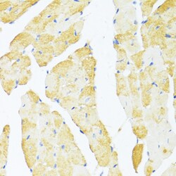 Invitrogen DDX3Y Polyclonal Antibody 100 &mu;L; Unconjugated:Antibodies,