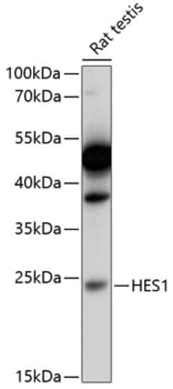 Invitrogen HES1 Polyclonal Antibody 100 &mu;L; Unconjugated:Antibodies,
