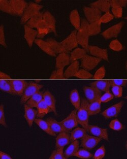 Invitrogen beta-Arrestin 2 Polyclonal Antibody 100 &mu;L; Unconjugated:Antibodies,