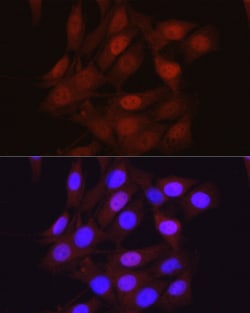 Invitrogen beta-Arrestin 2 Polyclonal Antibody 100 &mu;L; Unconjugated:Antibodies,
