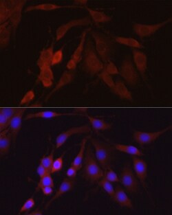 Invitrogen beta-Arrestin 2 Polyclonal Antibody 100 &mu;L; Unconjugated:Antibodies,