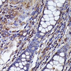 Invitrogen beta-Arrestin 2 Polyclonal Antibody 100 &mu;L; Unconjugated:Antibodies,