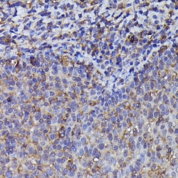 Invitrogen beta-Arrestin 2 Polyclonal Antibody 100 &mu;L; Unconjugated:Antibodies,