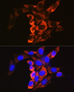 Invitrogen Calpain 1 Polyclonal Antibody 100 &mu;L; Unconjugated:Antibodies,