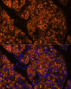 Invitrogen SERPINI2 Polyclonal Antibody 100 &mu;L; Unconjugated:Antibodies,