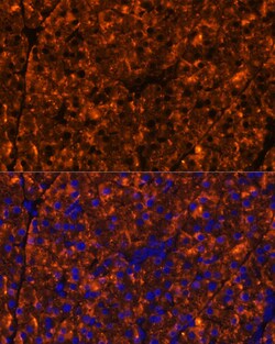 Invitrogen SERPINI2 Polyclonal Antibody 100 &mu;L; Unconjugated:Antibodies,