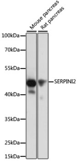 Invitrogen SERPINI2 Polyclonal Antibody 100 &mu;L; Unconjugated:Antibodies,