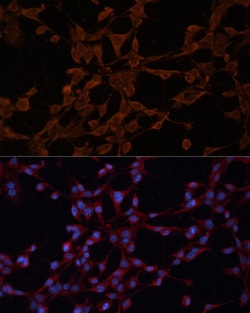Invitrogen P-Glycoprotein Polyclonal Antibody 100 &mu;L; Unconjugated:Antibodies,