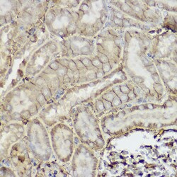 Invitrogen P-Glycoprotein Polyclonal Antibody 100 &mu;L; Unconjugated:Antibodies,