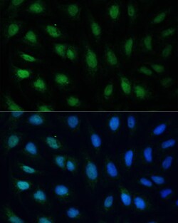 Invitrogen GADD45A Polyclonal Antibody 100 &mu;L; Unconjugated:Antibodies,