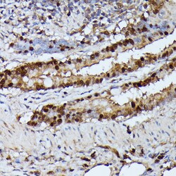 Invitrogen GADD45A Polyclonal Antibody 100 &mu;L; Unconjugated:Antibodies,
