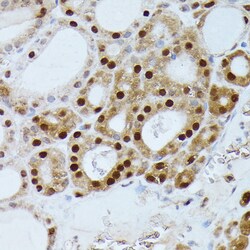 Invitrogen GADD45A Polyclonal Antibody 100 &mu;L; Unconjugated:Antibodies,