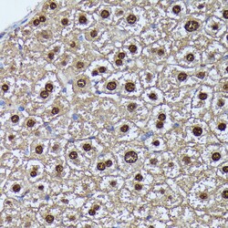 Invitrogen GADD45A Polyclonal Antibody 100 &mu;L; Unconjugated:Antibodies,