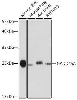 Invitrogen GADD45A Polyclonal Antibody 100 &mu;L; Unconjugated:Antibodies,