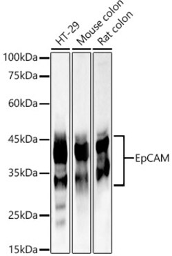 Invitrogen EpCAM Polyclonal Antibody 100 &mu;L | Buy Online | Invitrogen&trade; | Fisher Scientific