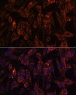 Invitrogen TLR3 Polyclonal Antibody 100 &mu;L | Buy Online | Invitrogen&trade; | Fisher Scientific