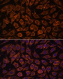 Invitrogen TLR3 Polyclonal Antibody 100 &mu;L | Buy Online | Invitrogen&trade; | Fisher Scientific