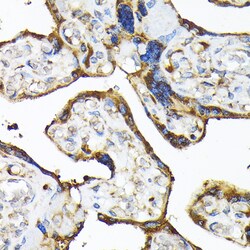 Invitrogen TLR3 Polyclonal Antibody 100 &mu;L | Buy Online | Invitrogen&trade; | Fisher Scientific