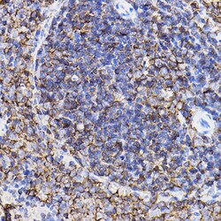 Invitrogen TGFBR2 Polyclonal Antibody 100 &mu;L; Unconjugated:Antibodies,