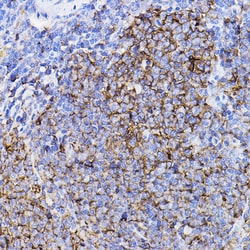 Invitrogen TGFBR2 Polyclonal Antibody 100 &mu;L; Unconjugated:Antibodies,