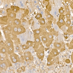 Invitrogen RAB5 Polyclonal Antibody 100 &mu;L | Buy Online | Invitrogen&trade; | Fisher Scientific
