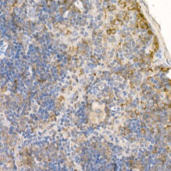 Invitrogen RAB5 Polyclonal Antibody 100 &mu;L | Buy Online | Invitrogen&trade; | Fisher Scientific