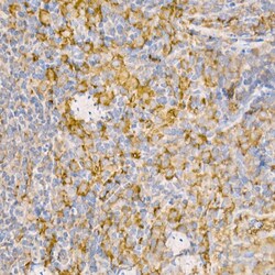 Invitrogen RAB5 Polyclonal Antibody 100 &mu;L | Buy Online | Invitrogen&trade; | Fisher Scientific
