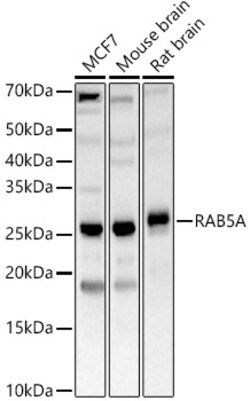Invitrogen RAB5 Polyclonal Antibody 100 &mu;L | Buy Online | Invitrogen&trade; | Fisher Scientific