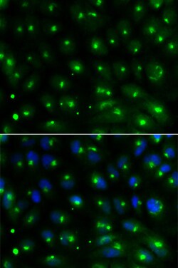 Invitrogen GGA2 Polyclonal Antibody 100 &mu;L; Unconjugated:Antibodies,
