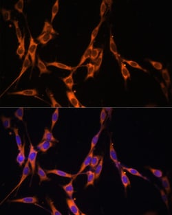 Invitrogen K-Ras Polyclonal Antibody 100 &mu;L; Unconjugated:Antibodies,