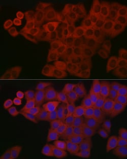 Invitrogen&trade;&nbsp;PDGF-BB Polyclonal Antibody