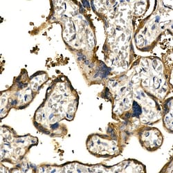 Invitrogen PDGF-BB Polyclonal Antibody 100 &mu;L | Buy Online | Invitrogen&trade; | Fisher Scientific