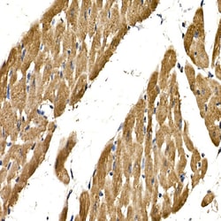 Invitrogen PDGF-BB Polyclonal Antibody 100 &mu;L | Buy Online | Invitrogen&trade; | Fisher Scientific