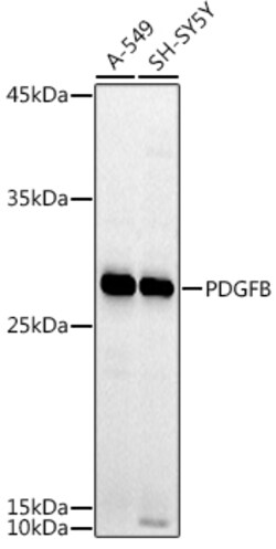 Invitrogen PDGF-BB Polyclonal Antibody 100 &mu;L | Buy Online | Invitrogen&trade; | Fisher Scientific