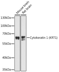 Invitrogen Cytokeratin 1 Polyclonal Antibody 100 &mu;L; Unconjugated:Antibodies,