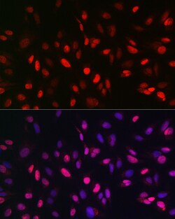 Invitrogen JMJD1A Polyclonal Antibody 100 &mu;L; Unconjugated:Antibodies,
