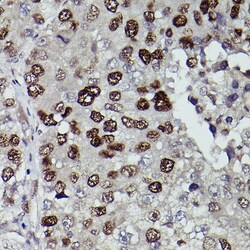 Invitrogen JMJD1A Polyclonal Antibody 100 &mu;L; Unconjugated:Antibodies,