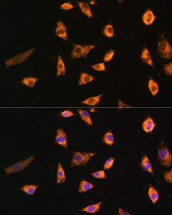 Invitrogen SPRR3 Polyclonal Antibody 100 &mu;L; Unconjugated:Antibodies,