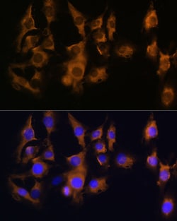 Invitrogen SPRR3 Polyclonal Antibody 100 &mu;L; Unconjugated:Antibodies,
