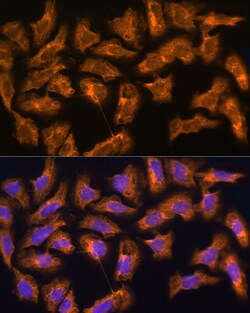 Invitrogen SPRR3 Polyclonal Antibody 100 &mu;L; Unconjugated:Antibodies,