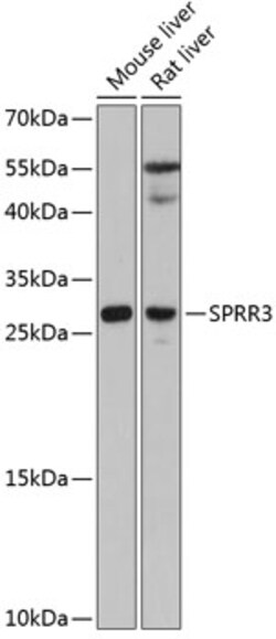 Invitrogen SPRR3 Polyclonal Antibody 100 &mu;L; Unconjugated:Antibodies,