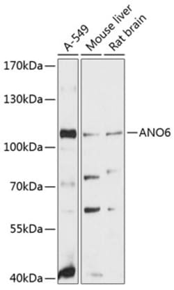 Invitrogen ANO6 Polyclonal Antibody 100 &mu;L; Unconjugated:Antibodies,