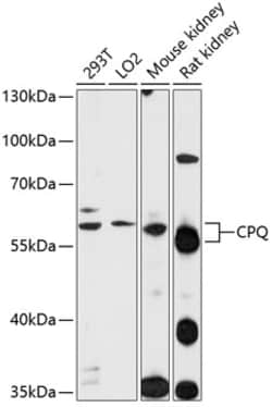 Invitrogen PGCP Polyclonal Antibody 100 &mu;L | Buy Online | Invitrogen&trade; | Fisher Scientific