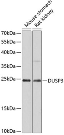 Invitrogen DUSP3 Polyclonal Antibody 100 &mu;L; Unconjugated:Antibodies,